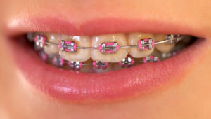 Real orthodontic answers