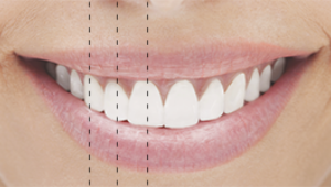 Do your teeth line up with your face?