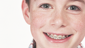 How do orthodontists bond braces to teeth?