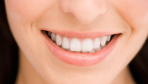 Clear Retainer