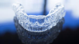 What happens after Invisalign treatment?