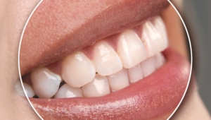 Why are my teeth crooked?