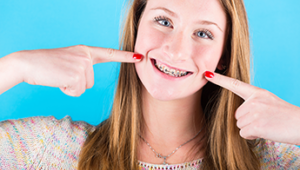 Does My Child Need a Palatal Expander?