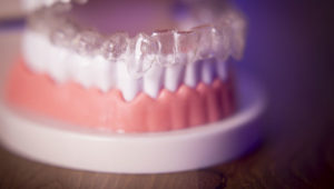 Could in-office 3D printing replace Invisalign?