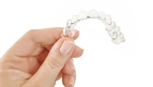 What is Invisalign Express?