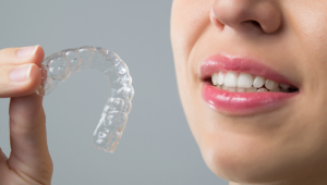Invisalign Express vs. traditional Invisalign