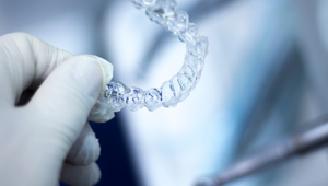 The art of moving teeth with Invisalign
