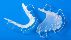 Do I really need a retainer?
