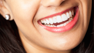Get it Straight: Busting myths about orthodontics