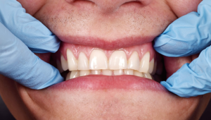 What shape are your gums?