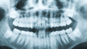 What is a dental cone beam image?