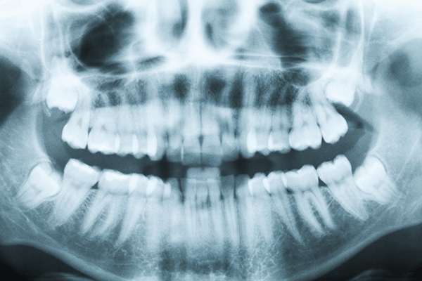 What is a dental cone beam image?